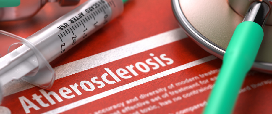 Atherosclerosis diagnosis